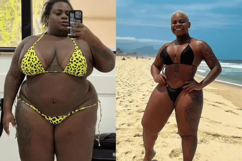 Jojo Todynho antes e depois
